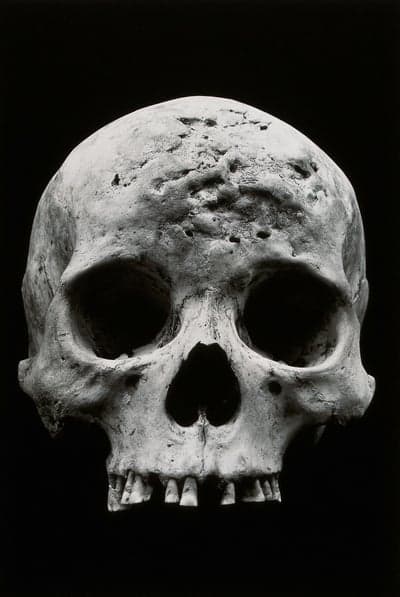 Close-up Black and White Human Skull Portrait