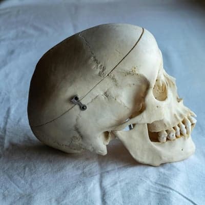 Side View of Human Skull Model with Detachable Jaw