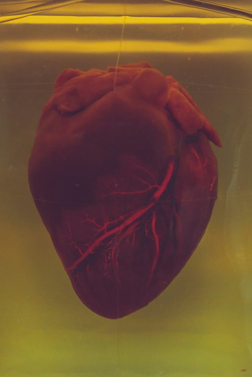 Human heart specimen in yellow liquid shows a complex network of red coronary arteries and muscle tissue.