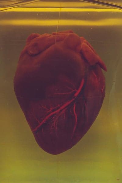 Preserved Human Heart with Visible Coronary Arteries