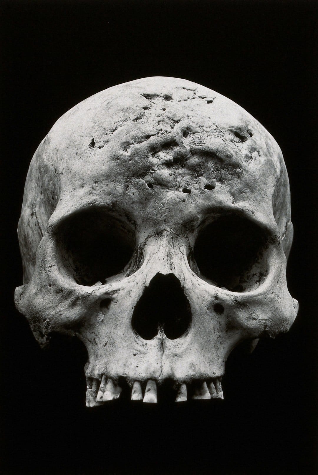 Human skull features sharp bone texture and deep shadows, emphasizing the weathered surface and nasal cavity.