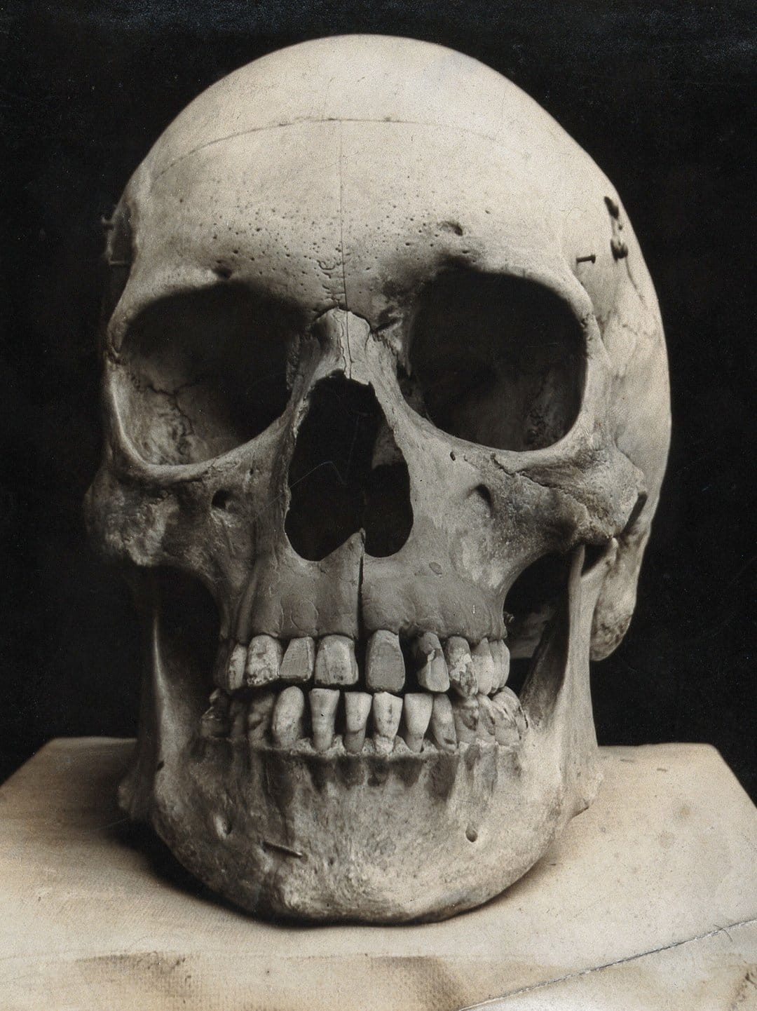 Human skull with detailed dental structures and bone texture against a solid black background in vertical view.